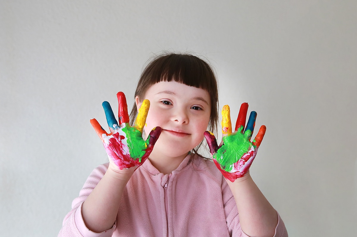 Child with Down Syndrome